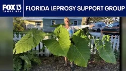 Rising leprosy rates leads one Florida woman to start support group