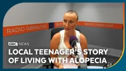 Local teenager shares her story of living with alopecia