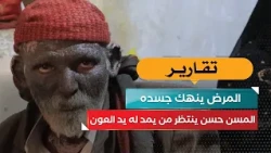 Illness Wreaks Havoc on His Body.. Elderly Hassan Awaits a Helping Hand
