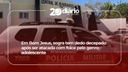 In Bom Jesus, mother-in-law has finger severed after being attacked with a scythe by teenage son-...