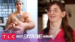 Mark and Rumeysa's Unique Conditions | Most Extreme Humans | TLC