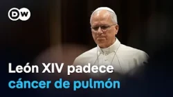 Vatican confirms Pope Leo XIV had part of his right lung removed due to a cancerous tumor