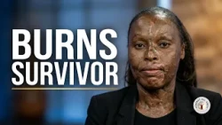 Against All Odds | Severe Fire Burns Survivor