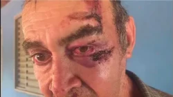 Man suffers accident on rural property in Carmo do Paranaíba and reports wait for SAMU assistance