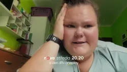 Těžké dětství na ní zanechalo hluboké stopy I Extrémní proměny Slovensko I Nova