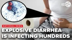 Explosive diarrhea is one symptom of a parasite outbreak in the U S