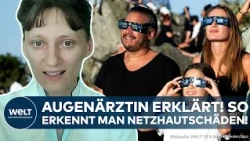 SOLAR ECLIPSE: Looked at the sun without protection? Ophthalmologist explains! How to spot burn d...