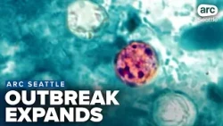 Cyclosporiasis outbreak expands to 9 states; Should Washington residents be worried?