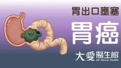 【大愛醫生館】 胃出口壅塞 20260723