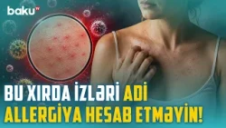 Qısa təmasla yoluxma riski: Ev heyvanınız fərqinə varmadan infeksiya mənbəyinə çevrilə bilər?
