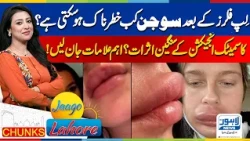 Lip Filler Side Effects | When Does Swelling Become Dangerous? | Jagoo Lahore