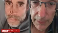 乗客が状況を説明、イスラエル行き旅客機での刺傷事件