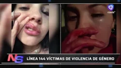 "Yo sentí que me iba a matar", expresó una mujer brutalmente golpeada por su pareja