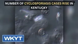 Number of cyclosporiasis cases rise in Kentucky