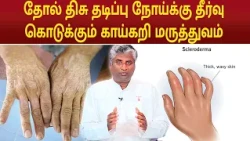 தோல் திசு தடிப்பு நோய்க்கு தீர்வு கொடுக்கும் காய்கறி மருத்துவம் | B.K.Arun Prakash |