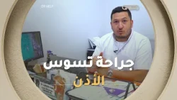 جراحة تسوس الأذن بالمنظار والميكروسوب وهذا بإشراف د. لعرابة أحمد عماد بعيادة بوكرو بقسنطينة 🧑‍⚕️🩺
