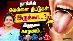👅 நாக்கில் வெள்ளை திட்டுகள் இருக்கா...? இதுதான் காரணம்...! 😷 Dr. Jayaroopa | #yugamconnect