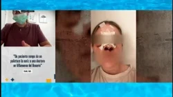 Doctor remains on medical leave after patient broke her nose without warning