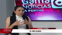 🔴 In-Depth | Melasma, the dark spots that appear on facial skin / 8-27-2026