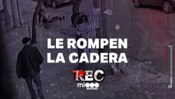 THEY BREAK HER HIP - LIKE A PLAGUE - #REC
