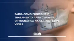 Everything You Need to Know About Orthognathic Surgery Treatment at the Felipe Vieira Clinic