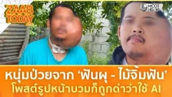 หนุ่มป่วยจาก ‘ฟันผุ - ไม้จิ้มฟัน’ โพสต์รูปหน้าบวมก็ถูกด่าว่าใช้ AI (10 ส.ค. 69) | แซ่บทูเดย์