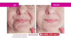TRAVOPAR Active Gold Wrinkle Correction Serum
