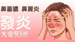 【大愛醫生館】 鼻蓄膿 鼻竇炎 20260724