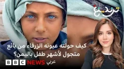 كيف حولته عيونه الزرقاء من بائع متجول لأشهر طفل باليمن؟