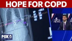 New drug cuts severe COPD flare-ups by 30%, study shows