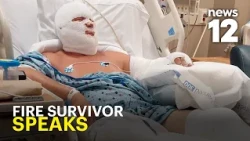 NY boat fire victim survives burns to 30% of his body