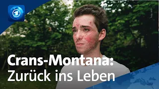 Überlebende von Crans-Montana: Der schwere Weg zurück ins Leben