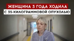 Woman lived for three years with a 77-pound tumor