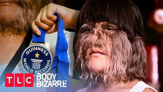 The Hairiest Teenager in the World and Other Hairy Situations | Body Bizarre | TLC