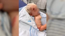 To-årige Emil blev kørt ned af dreng på ulovligt el-løbehjul