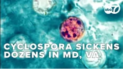 Cyclospora parasite sickens dozens across Maryland and Virginia, doctor says