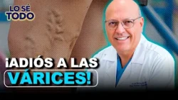 How to prevent varicose veins? Interview with Dr. Juan Guillermo Barrera | Lo Sé Todo