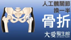 【大愛醫生館】 人工髖關節換一半 20261027