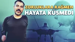 He lost both arms, but didn't give up: Now he’s a modeler for the KAAN fighter jet