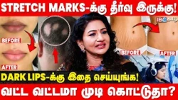 சருமத்தில் Stretch Marks வரக் காரணம் என்ன? Carolin Praba Reddy | Founder & MD V Care | IBC Tamil
