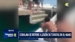 #TeleislasNews I Coralina se refiere a lesión de turistas en su mano.