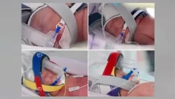 Woman gives birth to rare identical quadruplet daughters
