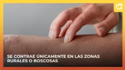 Mountain Leprosy: A Silent Threat