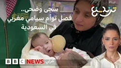 "أكبر حلم تحقق" برؤية توأم سيامي مغربي على سريرين بعد نجاح عملية فصلهما في السعودية