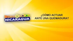 ¿Cómo actuar ante una quemadura?