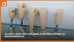 A prosthetic could make the difference: woman from Palacagüina asks for help