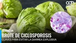 U.S. Alert: Explosive Diarrhea and Cyclosporiasis Spark Health Department Alarms