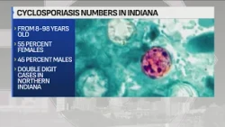 Indiana reports nearly 600 cases of cyclosporiasis