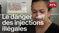 Acide hyaluronique : le business clandestin qui défigure des patientes | RTS