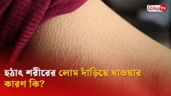 হঠাৎ শরীরের লোম দাঁড়িয়ে যাওয়ার কারণ কি? Bijoy TV